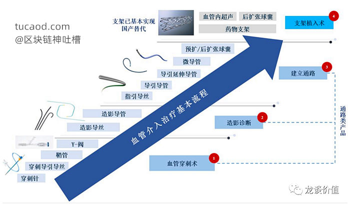 血管介入产品@龙谈价值